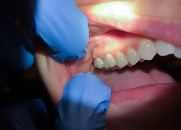 Best Emergency Cosmetic Dentistry (e.g., broken veneers) in Kentwood, MI